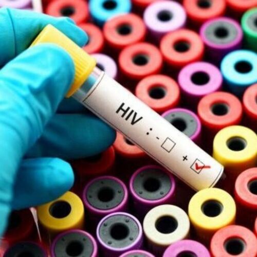 Estados Unidos aprueba revolucionaria inyección preventiva contra el VIH