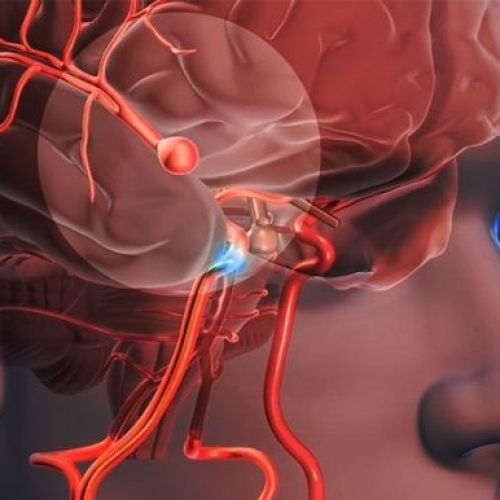 Daño Cerebral Adquirido (DCA): ¿Cómo podemos prevenirlo?