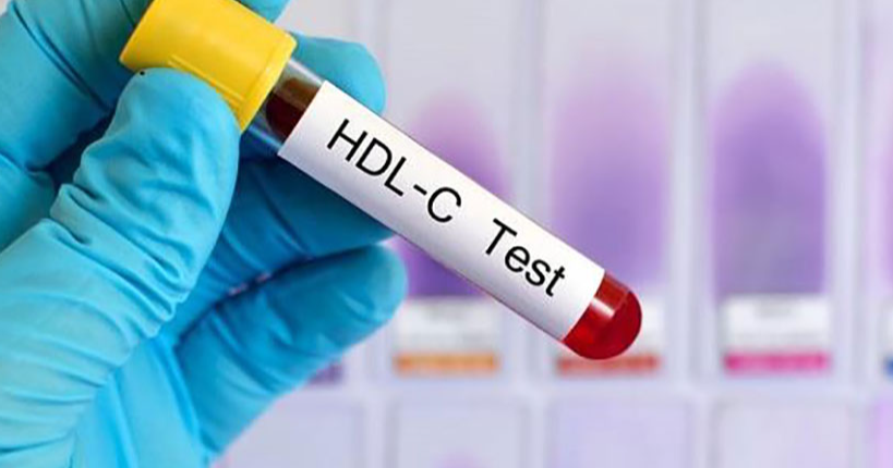 Asocian una gran elevación en el HDL con la mortalidad CV en la EAC