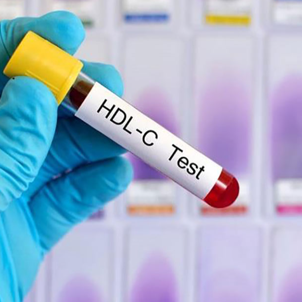 Asocian una gran elevación en el HDL con la mortalidad CV en la EAC