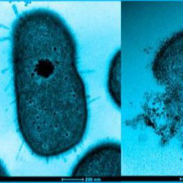 Visualizan cómo bacterias hospitalarias resisten a los antibióticos