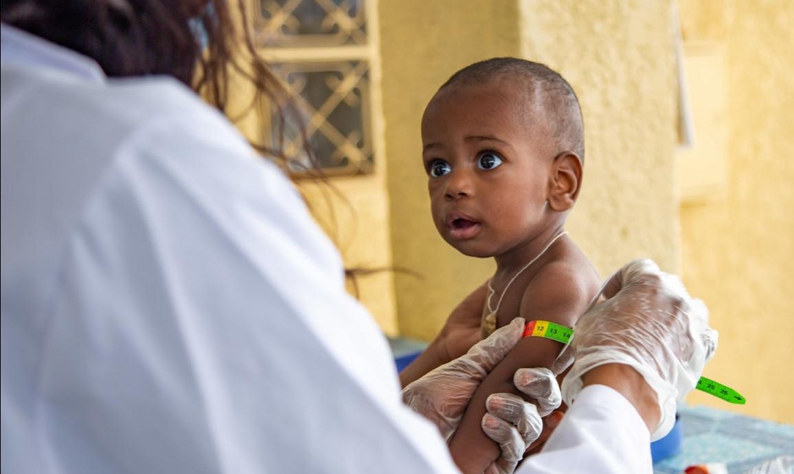 Otros 6,7 millones de niños menores de 5 años podrían sufrir de desnutrición aguda severa este año debido a la COVID-19, según UNICEF