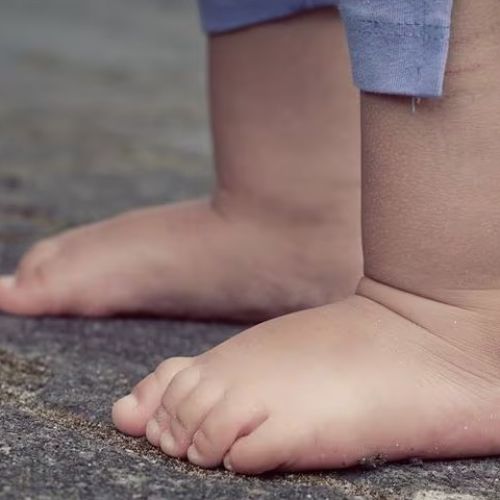 Estos son los países con más niños obesos según un informe mundial