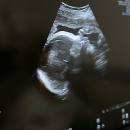 Medicaid en Georgia: Ofrecen recursos para ayudar a las futuras madres de Georgia