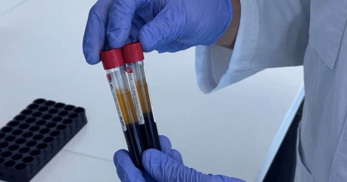 Costa Rica introducirá prueba de sangre avanzada para detección temprana de cáncer