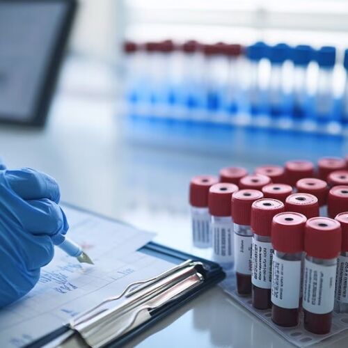 Cuáles son los 4 análisis de sangre claves que todas las personas mayores de 40 años deben realizar