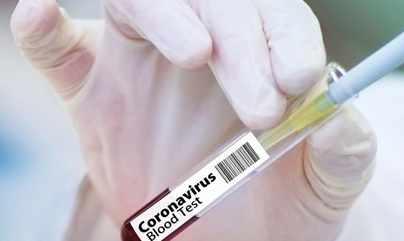 Farmacéutica GSK anuncia que está trabajando en una vacuna para combatir el Covid-19