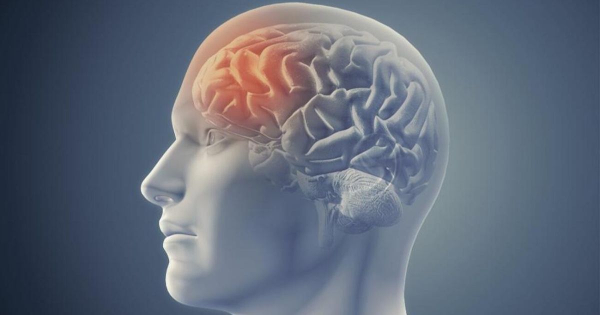 Nuevo examen para detectar derrames cerebrales